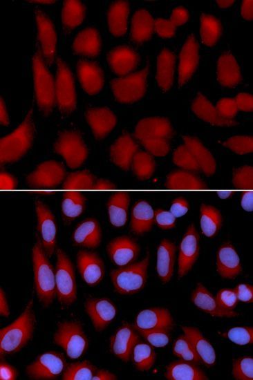 Immunofluorescence - TAP2 antibody (144-01610)