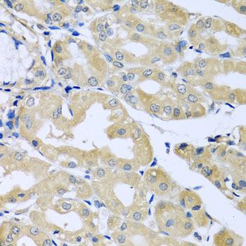 Immunohistochemistry - HS1BP3 antibody (144-08250)