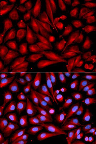 Immunofluorescence - MAP2K7 Polyclonal Antibody (144-02186)