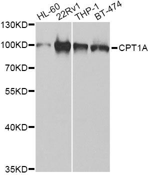 Western blot - CPT1A Polyclonal Antibody (144-05307)