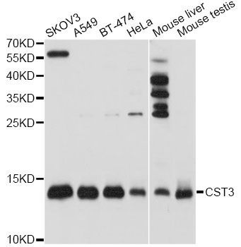 Western blot - CST3 Polyclonal Antibody (144-01561)