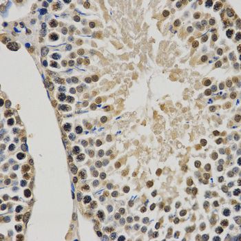 Immunohistochemistry - MonoMethyl-Histone H3-K9 pAb (144-02358)