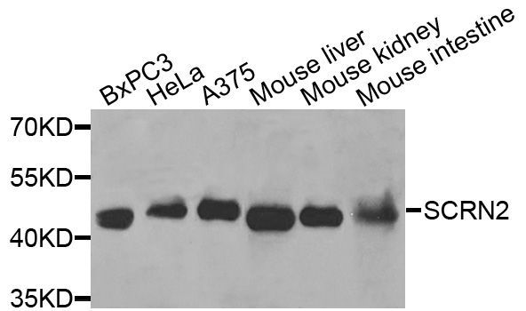 Western blot - SCRN2 antibody (144-01205)