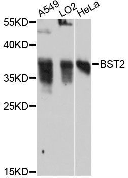 Western blot - BST2 Polyclonal Antibody (144-012315)