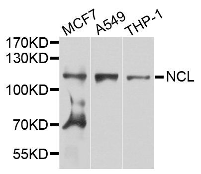 Western blot - NCL Polyclonal Antibody (144-05904)