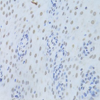 Immunohistochemistry - HNRNPK Antibody (144-01701)