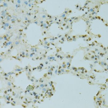 Immunohistochemistry - SAFB antibody (144-07927)