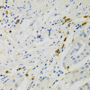 Immunohistochemistry - RELA Polyclonal Antibody (144-02547)