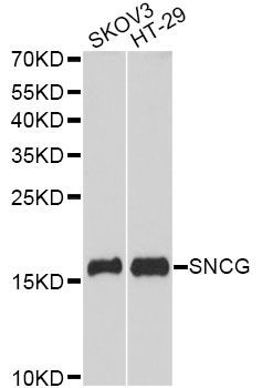 Western blot - SNCG antibody (144-60678)