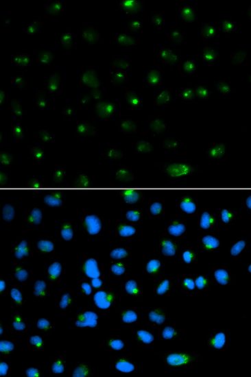 Immunofluorescence - PSAP antibody (144-01819)