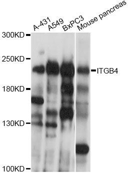 Western blot - ITGB4 Polyclonal Antibody (144-60036)