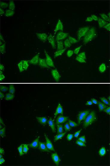Immunofluorescence - BNIP2 antibody (144-06282)