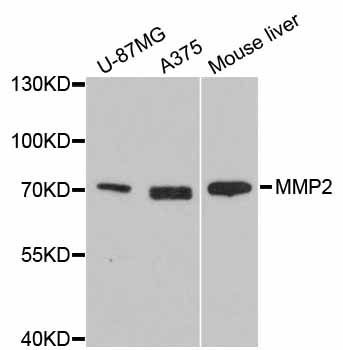 Western blot - MMP2 antibody (144-06247)
