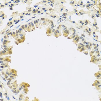 Immunohistochemistry - TGFB3 Polyclonal Antibody (144-08460)