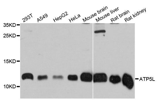 Western blot - ATP5L antibody (144-09178)