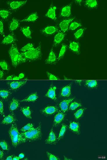 Immunofluorescence - MCCC2 Polyclonal Antibody (144-015181)