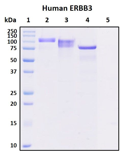 SDS-PAGE