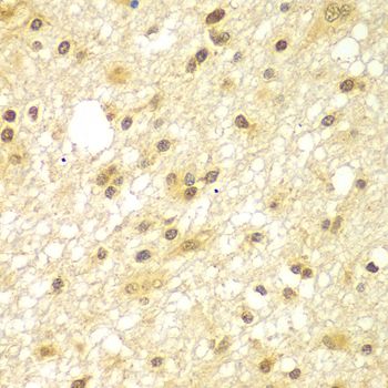Immunohistochemistry - TBL1XR1 antibody (144-07834)