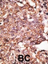 IHC-P