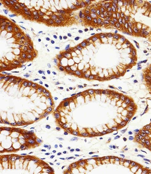 IHC-P