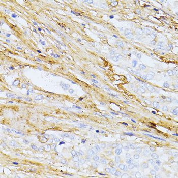 Immunohistochemistry - TGFBI antibody (144-02561)