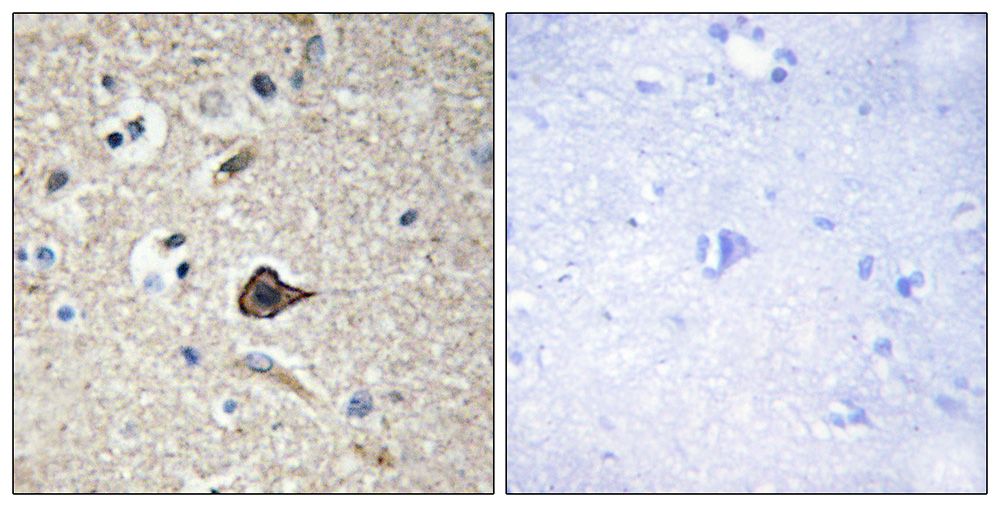 IHC