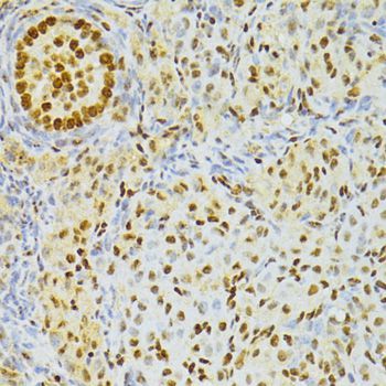 Immunohistochemistry - ALYREF antibody (144-06010)