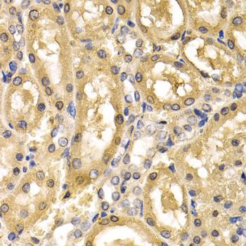 Immunohistochemistry - ADH4 antibody (144-05454)