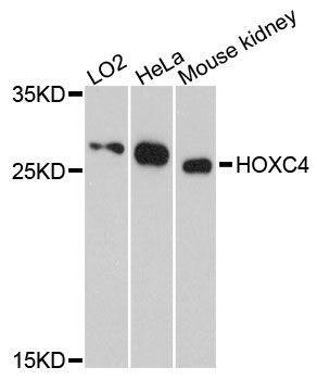 Western blot - HOXC4 antibody (144-61462)