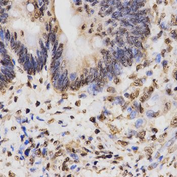 Immunohistochemistry - TriMethyl-Histone H3-K27 pAb (144-02363)