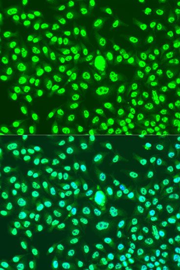 Immunofluorescence - CCNA2 antibody (144-07632)