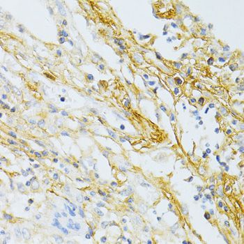 Immunohistochemistry - TGFBI antibody (144-02561)