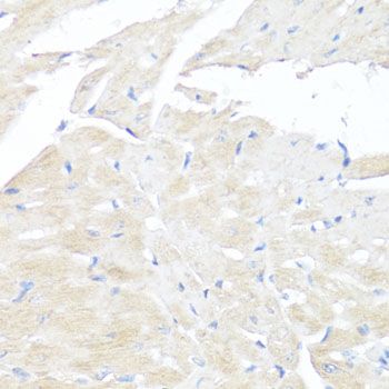 Immunohistochemistry - FGFR2 antibody (144-02074)