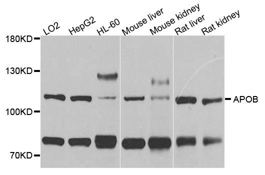 Western blot - APOB antibody (144-01330)