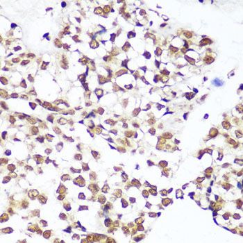Immunohistochemistry - MonoMethyl-Histone H3-K9 pAb (144-02358)