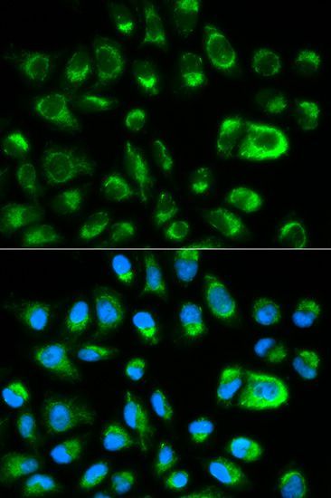 Immunofluorescence - GAS2 antibody (144-01168)