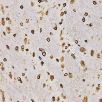 Immunohistochemistry - TriMethyl-Histone H3-K27 pAb (144-02363)
