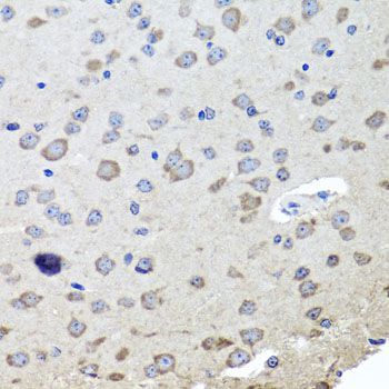 Immunohistochemistry - CHRNB2 Polyclonal Antibody (144-09808)