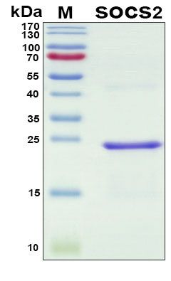 SDS-PAGE