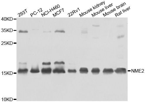 Western blot - NME2 antibody (144-07443)