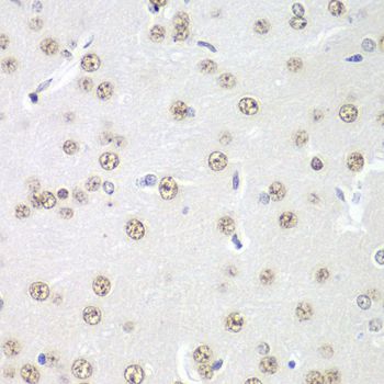 Immunohistochemistry - PRMT5 antibody (144-01520)