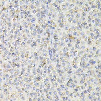 Immunohistochemistry - CD74 Antibody (144-05667)