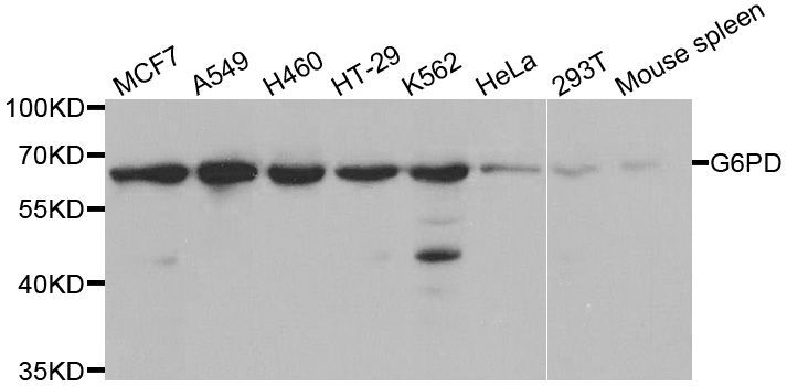 Western blot - G6PD antibody (144-01537)
