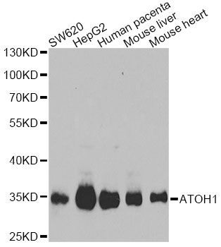 Western blot - ATOH1 Polyclonal Antibody (144-06530)