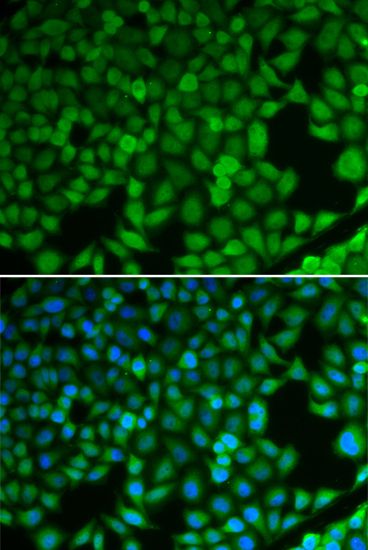 Immunofluorescence - NDRG1 Polyclonal Antibody (144-02142)