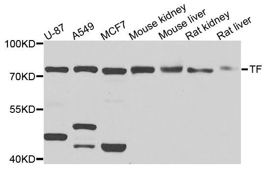 Western blot - TF Polyclonal Antibody (144-01448)