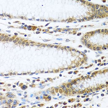 Immunohistochemistry - IFI44 antibody (144-08188)