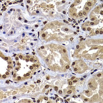 Immunohistochemistry - DNAJB6 Polyclonal Antibody (144-07052)