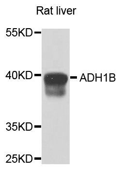 Western blot - ADH1B antibody (144-01431)