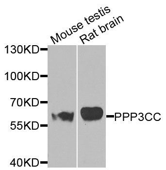 Western blot - PPP3CC antibody (144-07714)